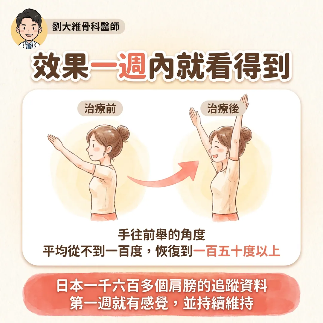 五十肩無聲鬆動術（Silent Manipulation）完整整理 衛教圖 8