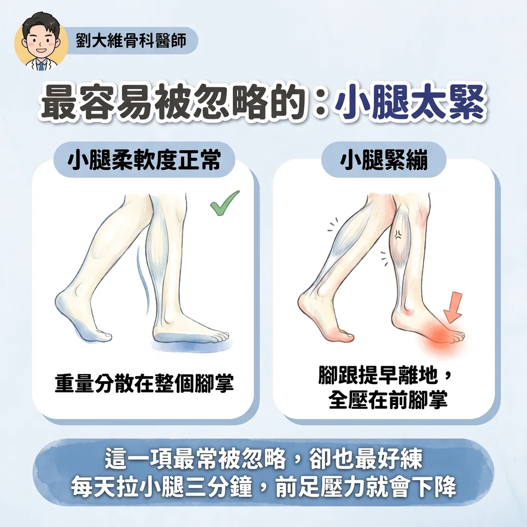 前足蹠骨痛（Metatarsalgia）的原因與治療 衛教圖 4