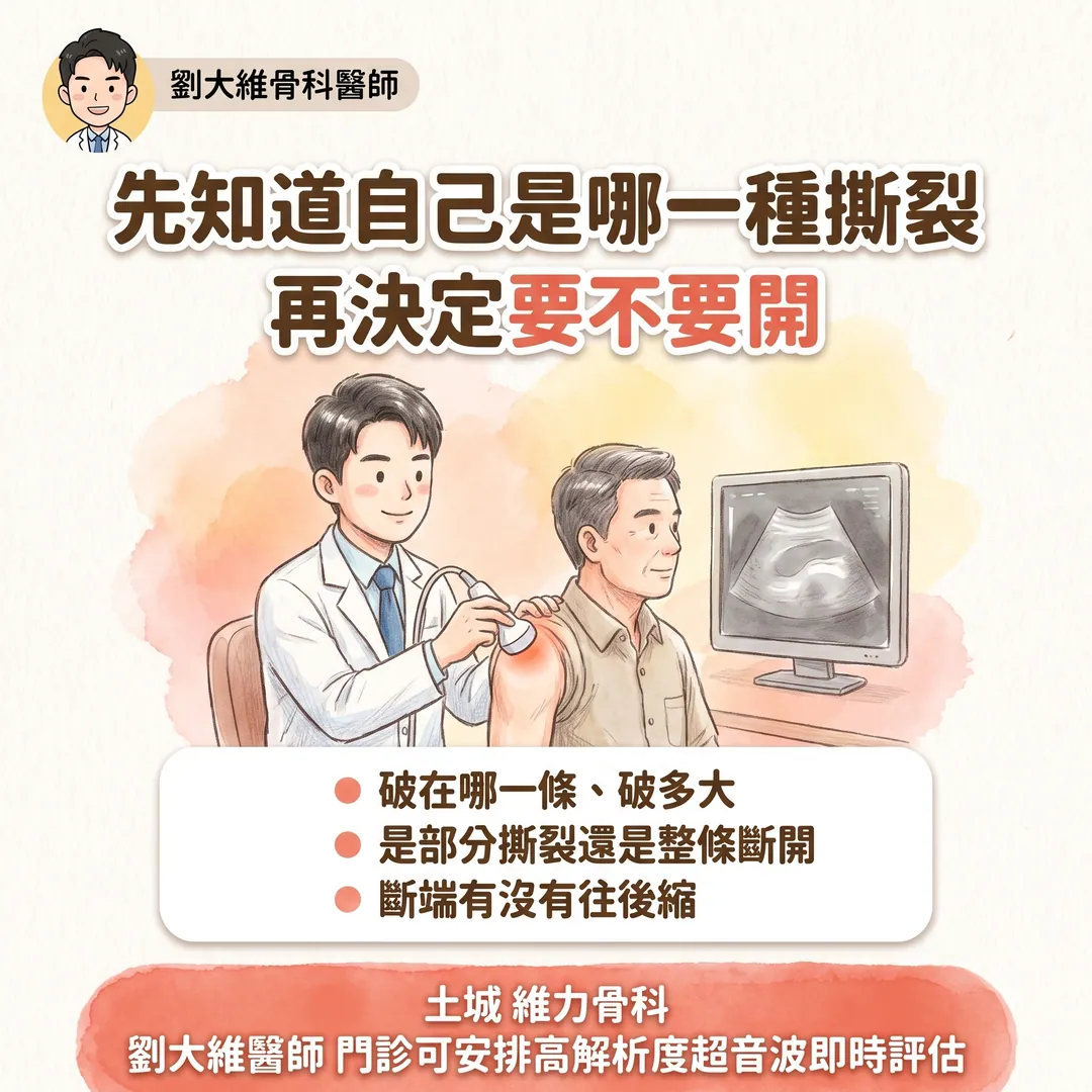 旋轉肌袖撕裂：什麼時候該開刀？PRP 到底有沒有效？ 衛教圖 10