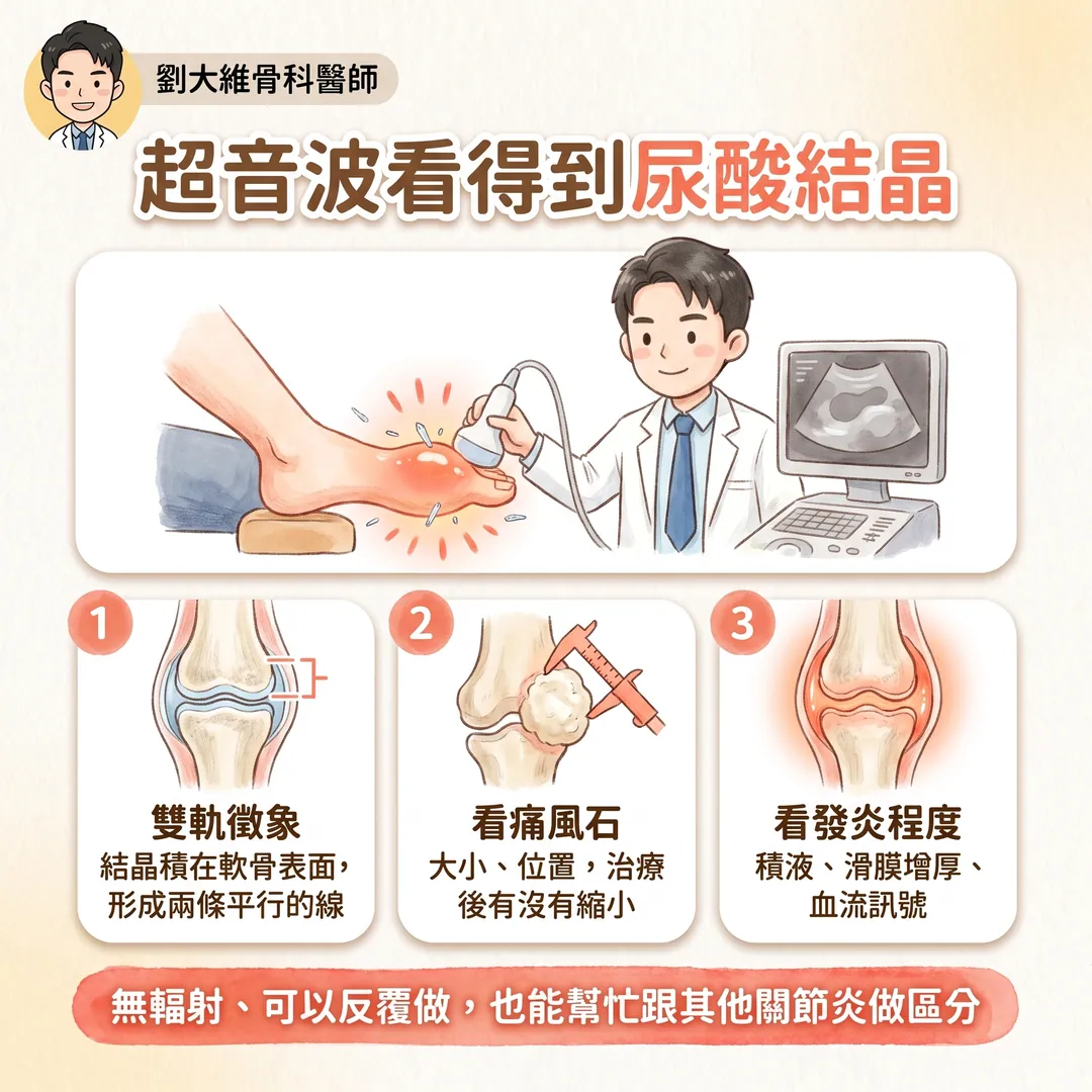 痛風發作怎麼辦 衛教圖 9