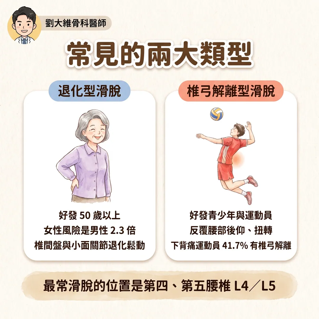 腰椎滑脫症是什麼?為什麼站久走久就腰痠腿麻?醫師教你怎麼預防 衛教圖 3