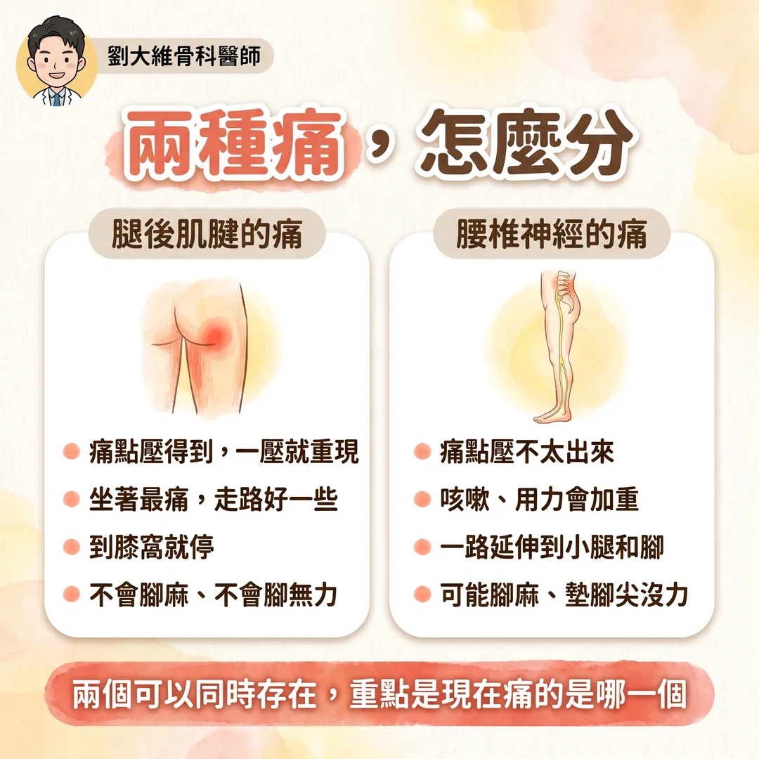 近端腿後肌腱病變（高位腿後肌拉傷）為什麼常被誤診為腰椎椎間盤突出 衛教圖 7