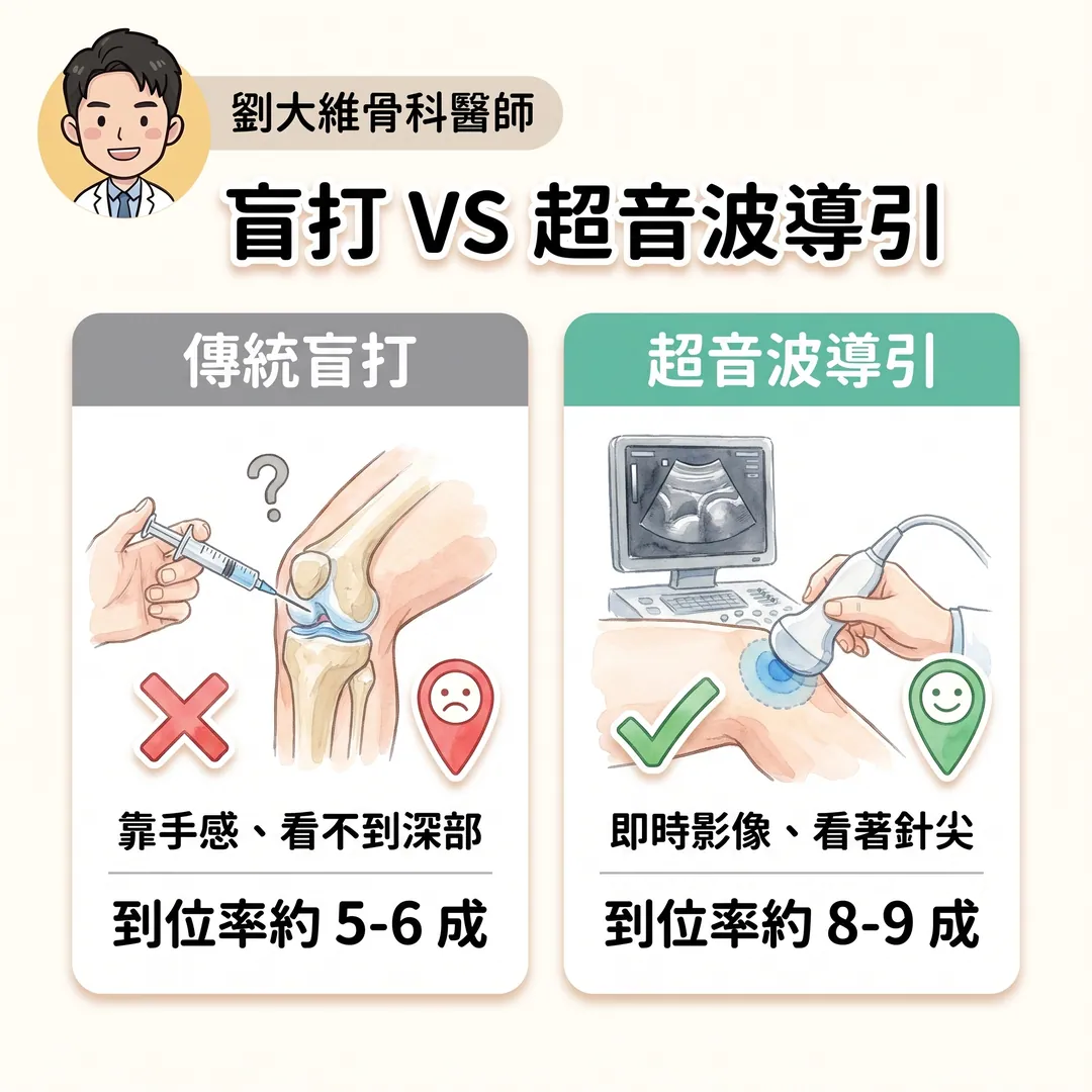 為什麼疼痛治療要用「超音波導引注射」?骨科醫師告訴你關鍵差別 衛教圖 3
