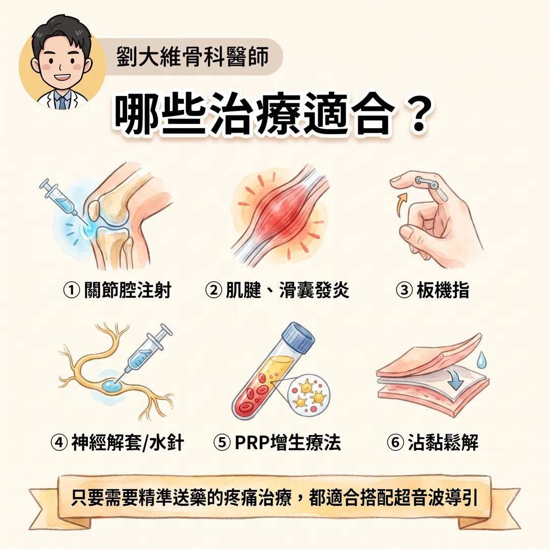 為什麼疼痛治療要用「超音波導引注射」?骨科醫師告訴你關鍵差別 衛教圖 7