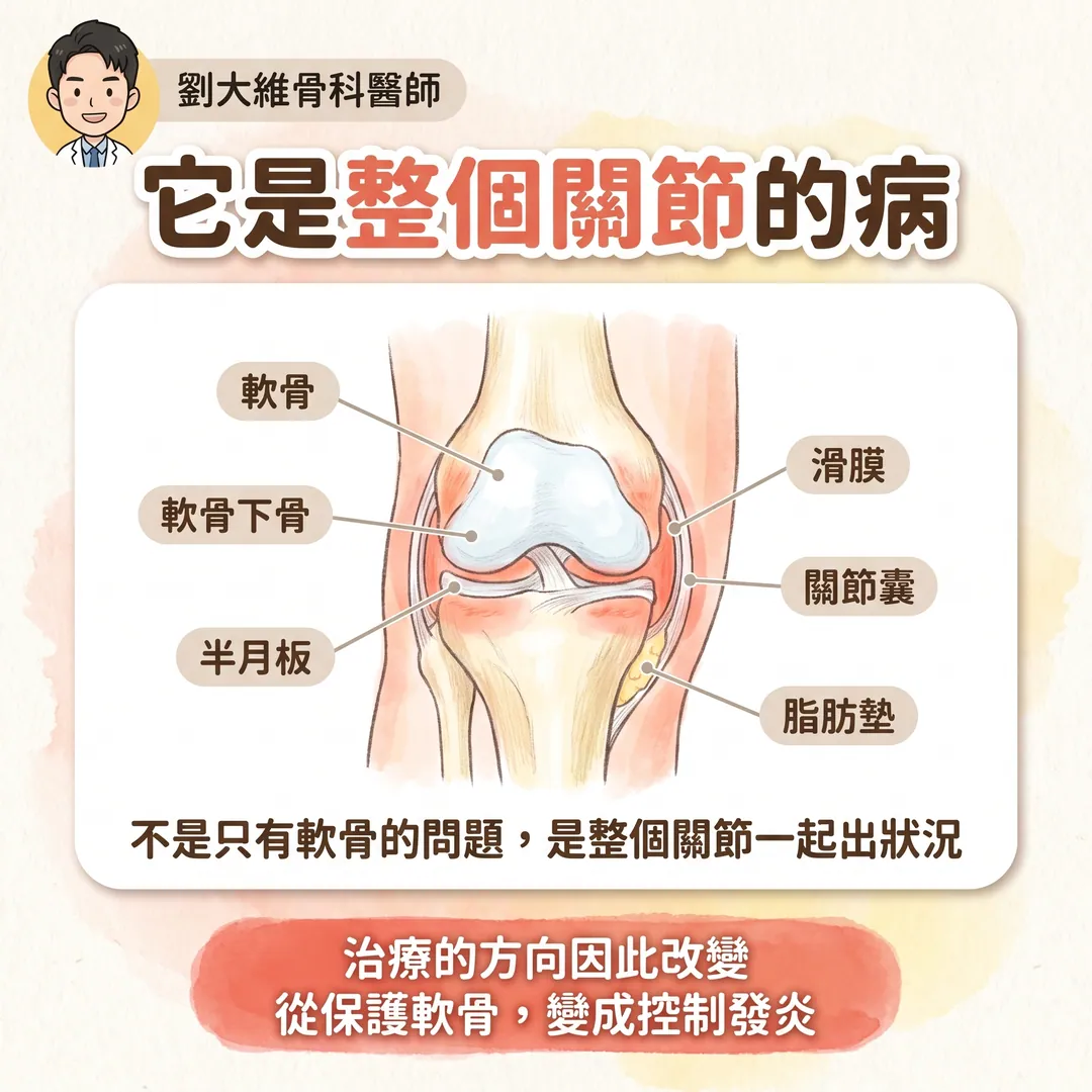退化性關節炎：或許重點不是退化，而是發炎 衛教圖 6