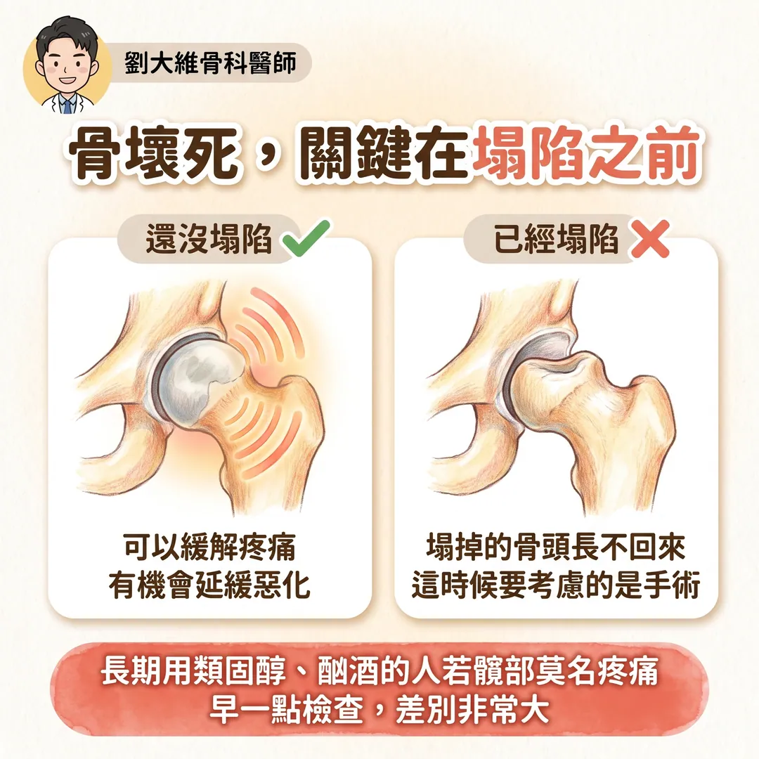 震波治療（ESWT）完整整理：原理、適應症、以及骨不癒合與骨壞死的應用 衛教圖 8