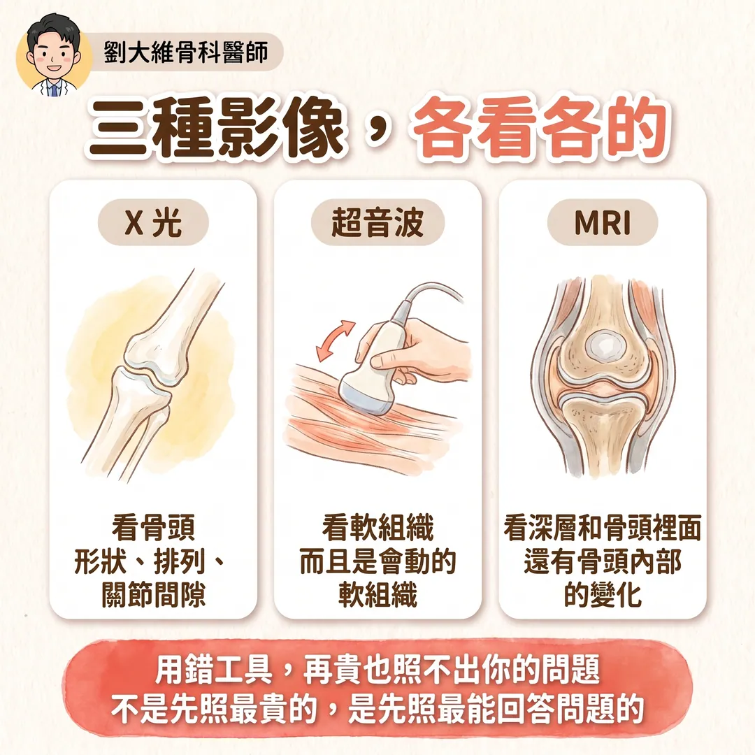 骨科影像金三角：X 光、超音波、MRI 各自看什麼、優缺點 衛教圖 2