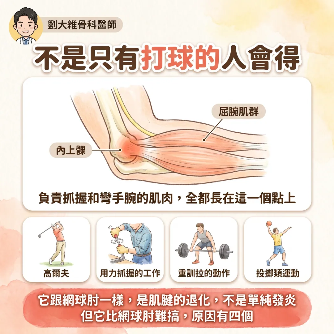 高爾夫球肘(內上髁肌腱病變):為什麼比網球肘難治 衛教圖 2