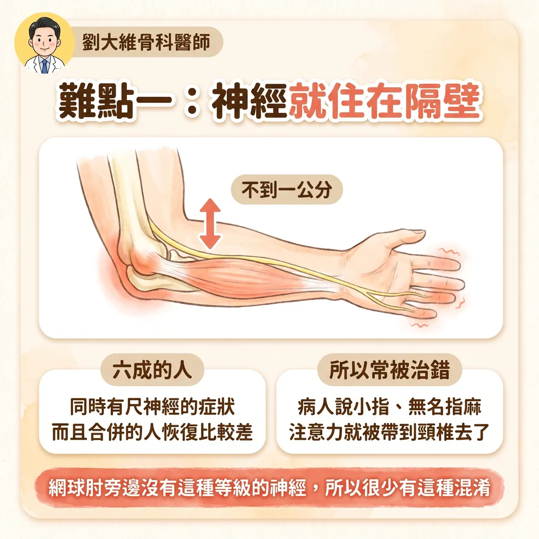 高爾夫球肘(內上髁肌腱病變):為什麼比網球肘難治 衛教圖 3
