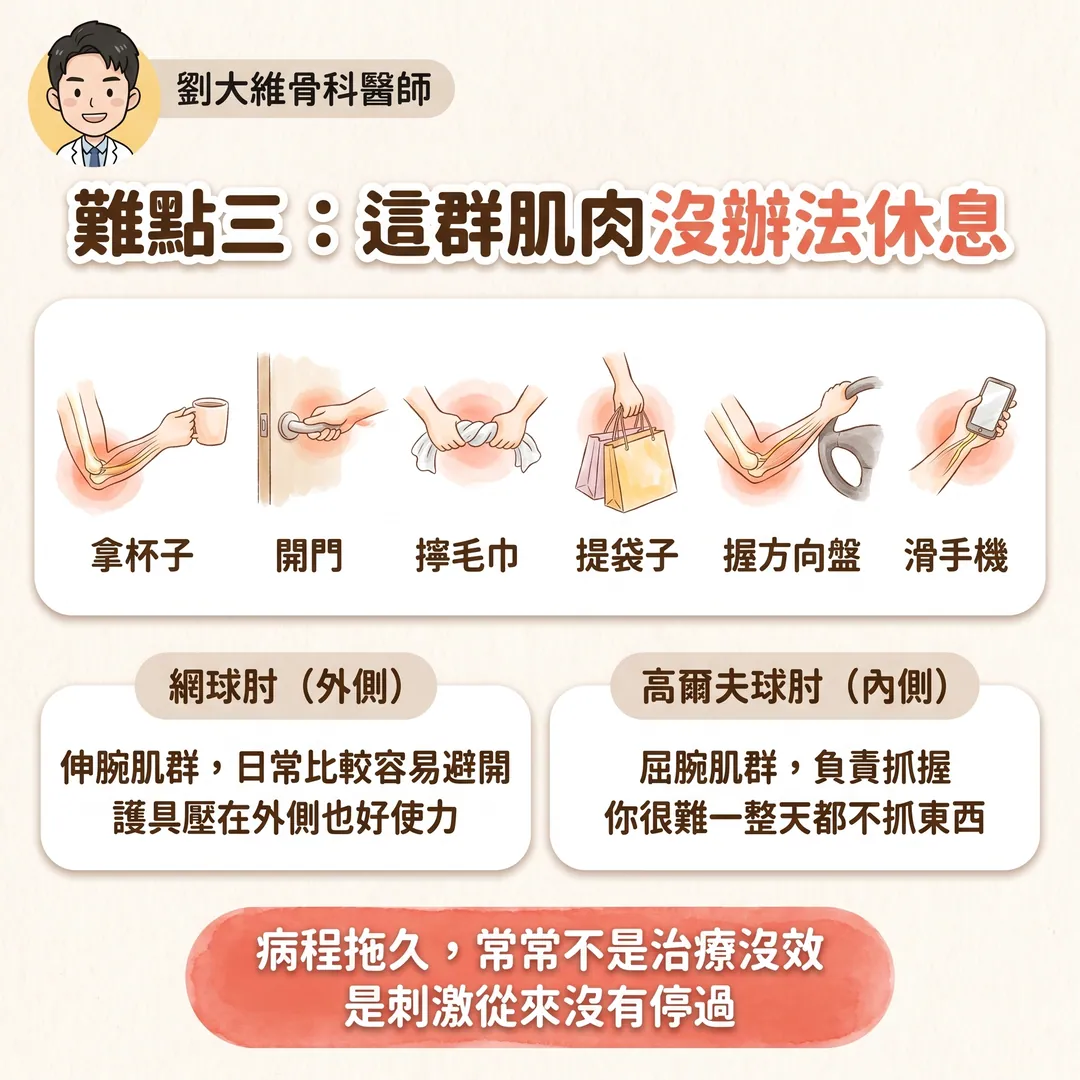 高爾夫球肘(內上髁肌腱病變):為什麼比網球肘難治 衛教圖 5