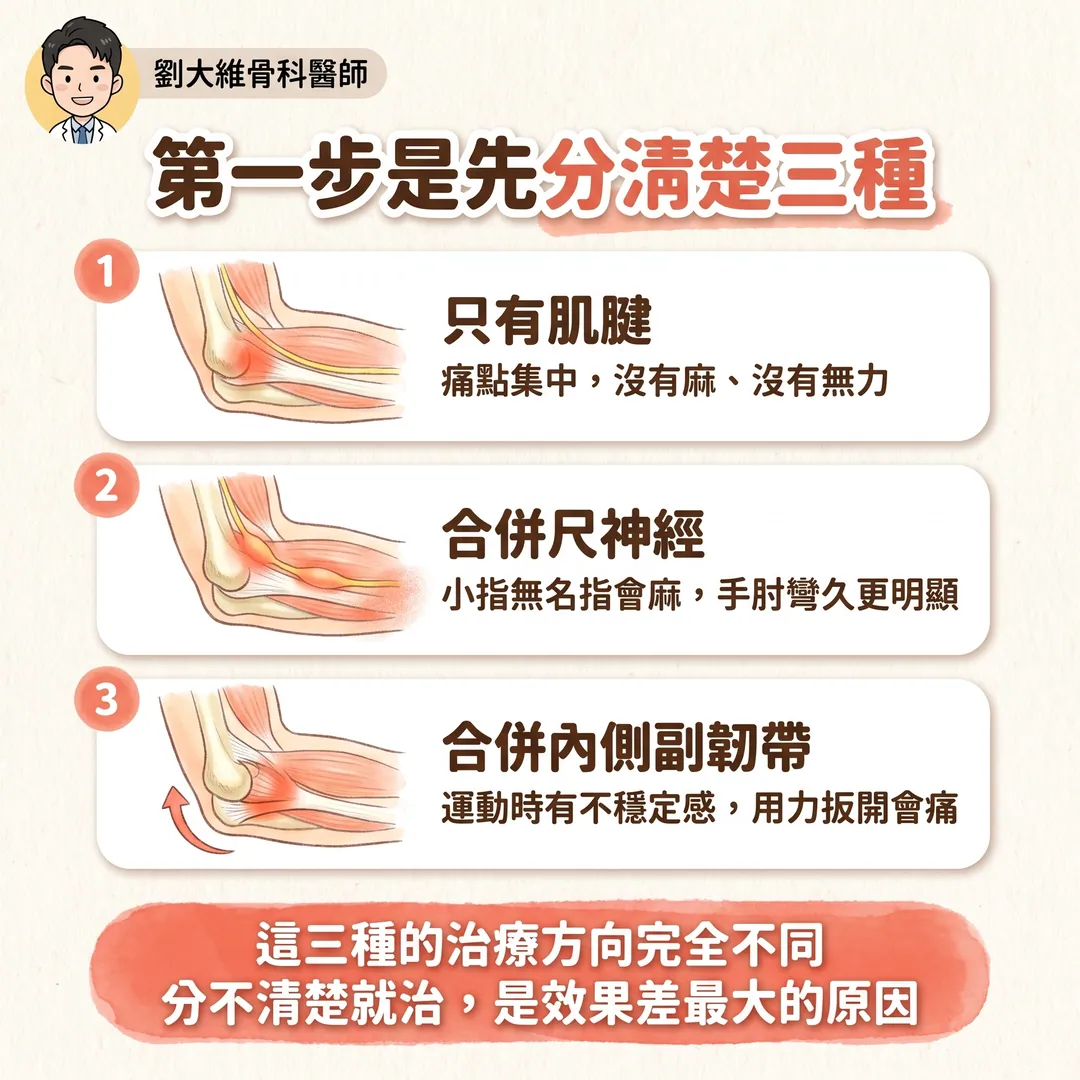 高爾夫球肘(內上髁肌腱病變):為什麼比網球肘難治 衛教圖 7