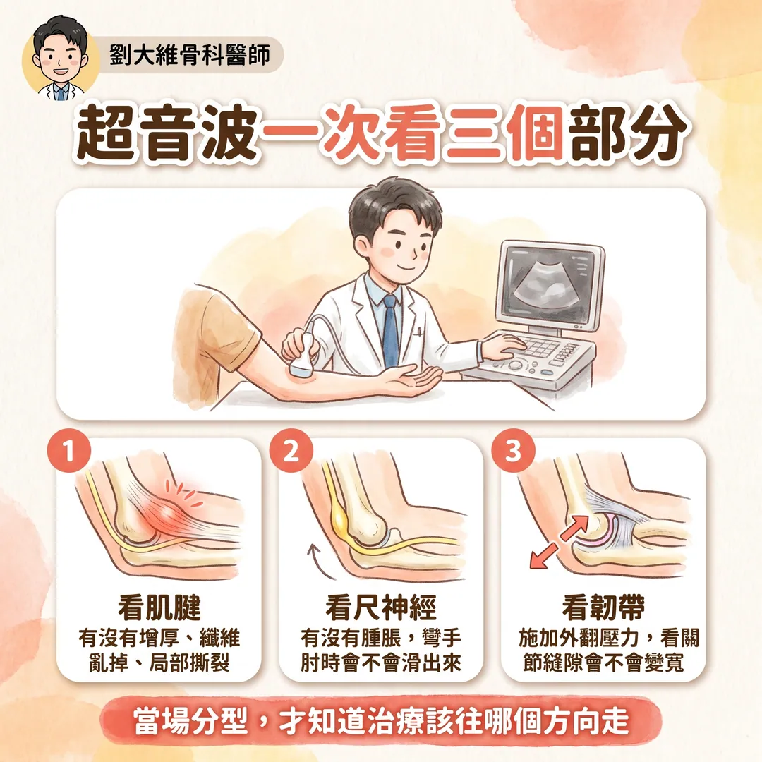 高爾夫球肘(內上髁肌腱病變):為什麼比網球肘難治 衛教圖 8
